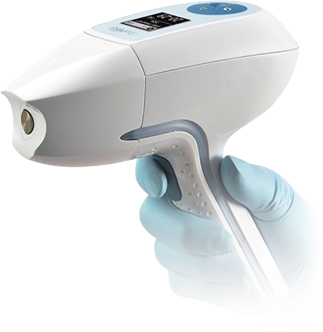 UltraMist handheld ultrasound therapy applicator